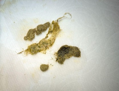 An image of fur clumps removed from the stomach of a rabbit that underwent surgery.